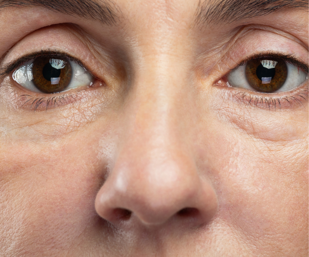 10 Signs of Aging Skin and What You Can Do About It